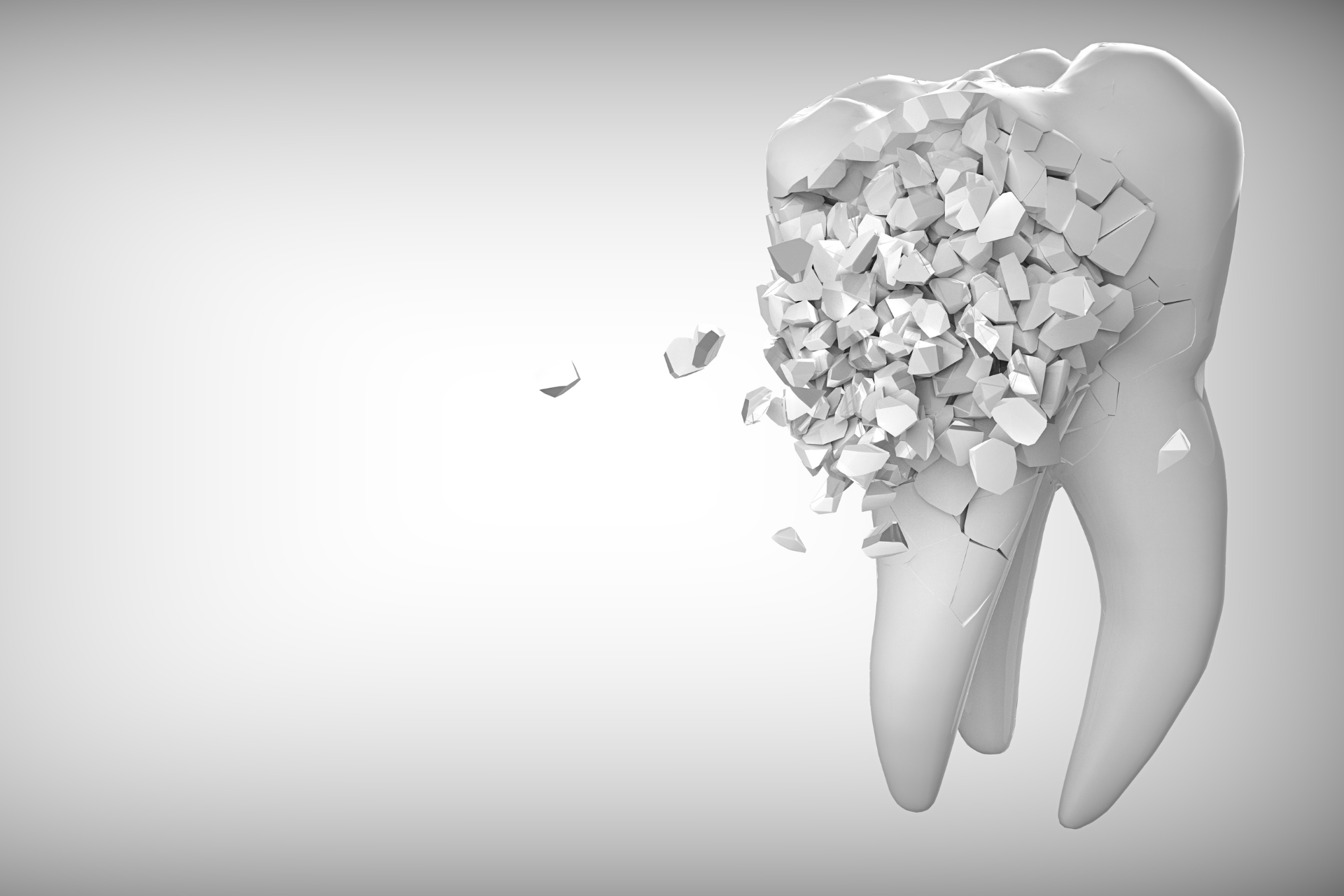 歯がボロボロだと治療費が高くなる？